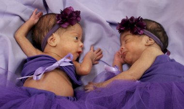 Hospital Estadual da Criança celebra a força dos prematuros com ensaio fotográfico no Novembro Roxo